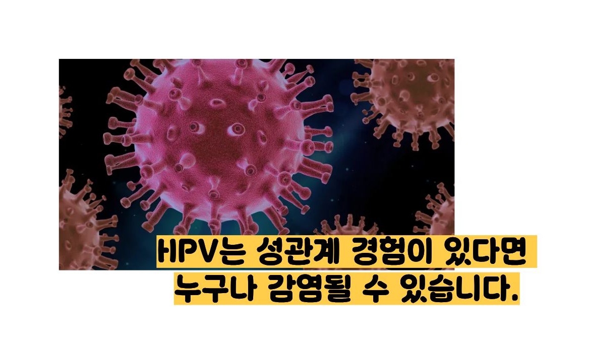 인유두종 바이러스 증상