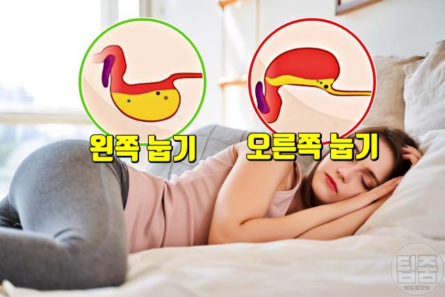 역류성식도염 자가치료 수면자세