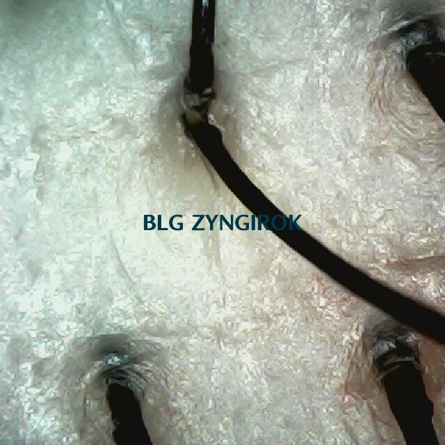 뒷머리 두피 모습이다.