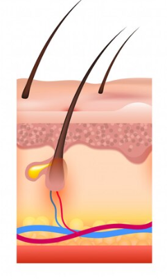 코코이비인후과 탈모약 처방 실제 후기
