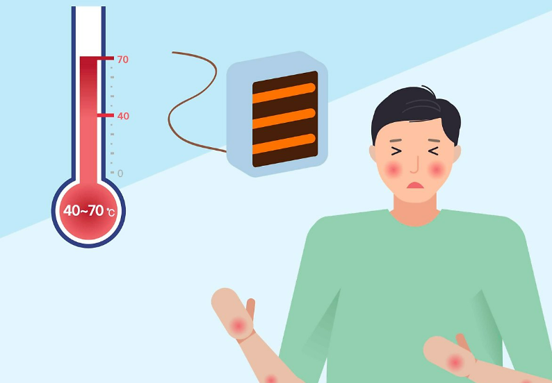 저온화상 이미지