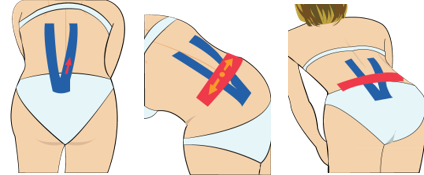 허리 통증 1 (일반적인 요통일 때)