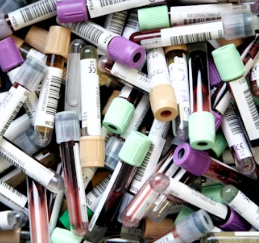 대상포진 치료방법 진단 기준 합병증