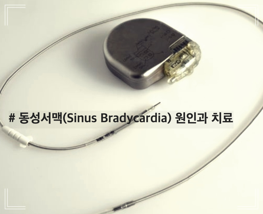 # 동성서맥(Sinus Bradycardia) 원인과 치료
