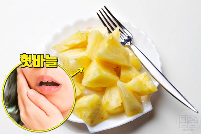 파인애플 먹고 혀가 아파요,혓바늘