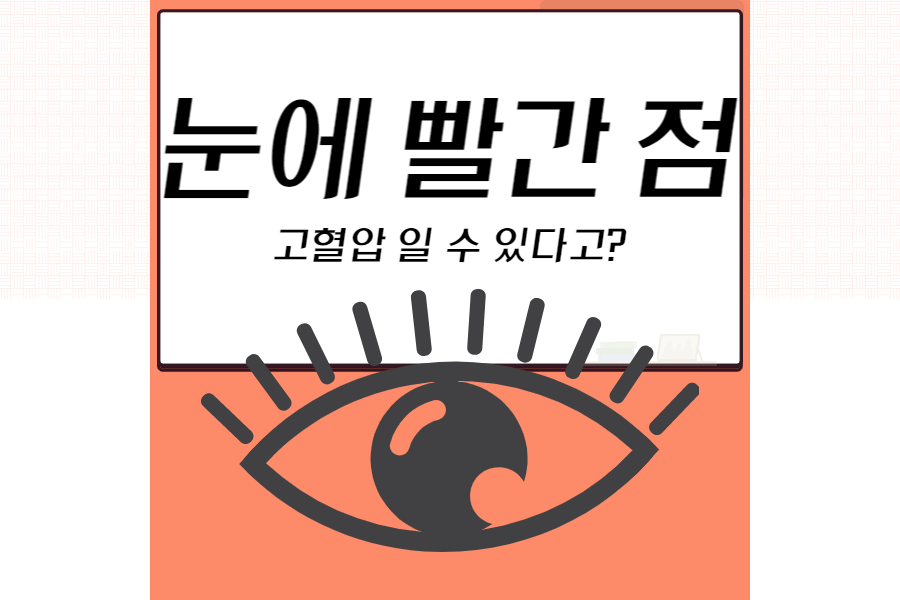 섬네일