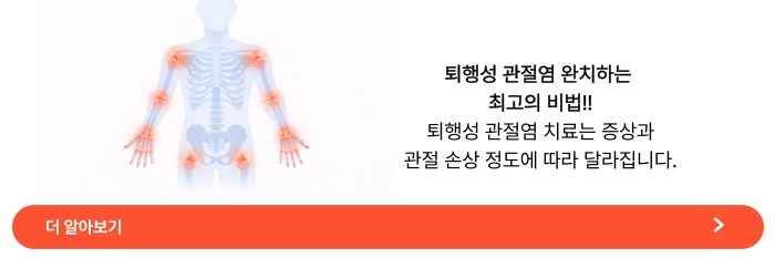 퇴행성 관절염 완치하는 최고의 비법