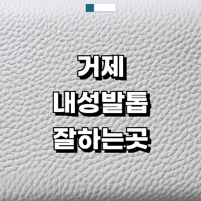 거제시 내성발톱