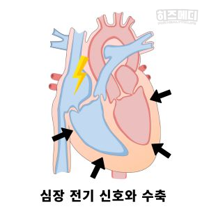 동성서맥
