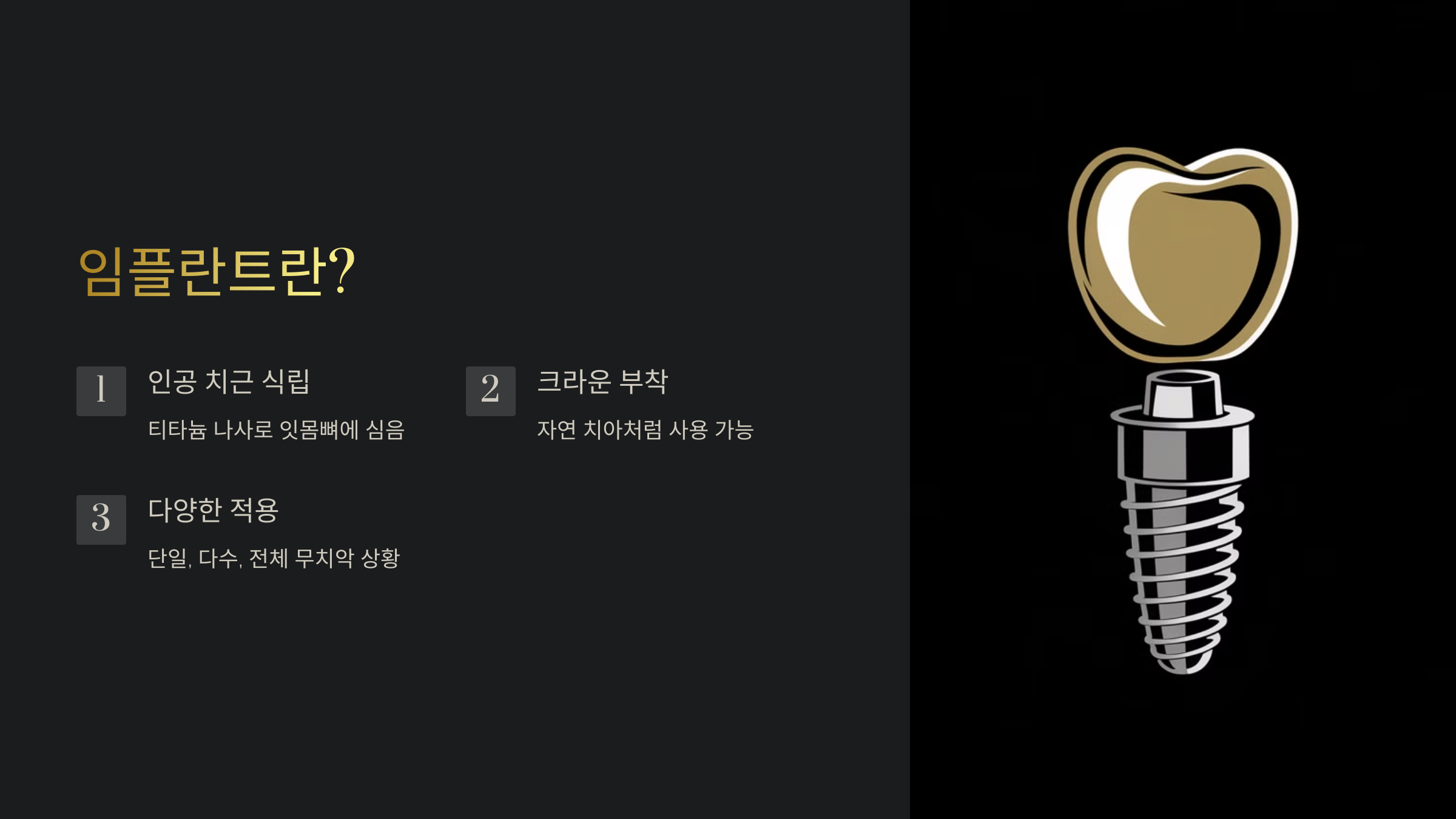 임플란트란 무엇인가?