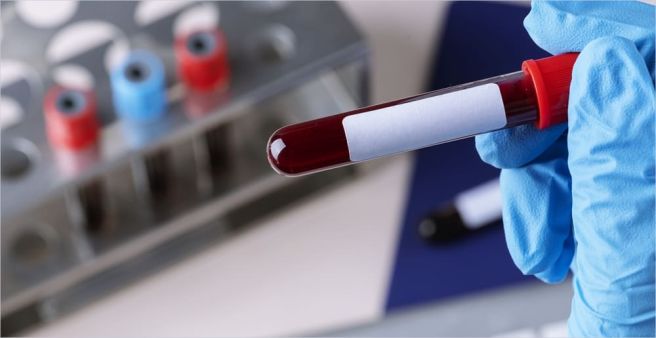 Ferritin 수치