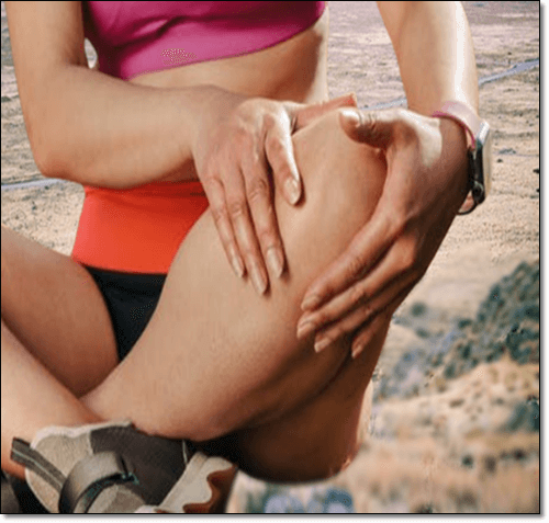 무리하게 운동한 관절염 환자