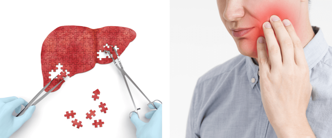 간 사진, 얼굴 염증 사진