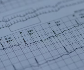 협심증 진단방법 치료법 합병증 예방