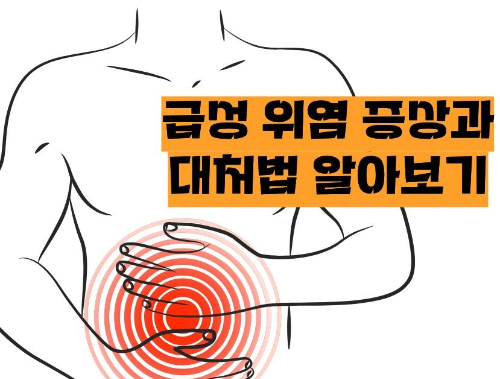 급성 위염 증상과 원인, 치료 및 예방법