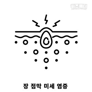 과민성 대장 증후군 증상 원인