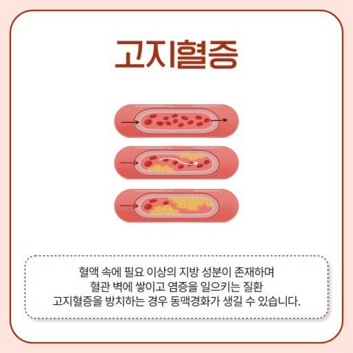 혈전 용해