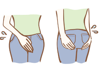 칸디다 질염