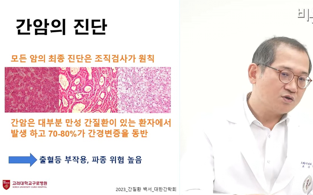 지방간염-김지훈-교수-간암진단