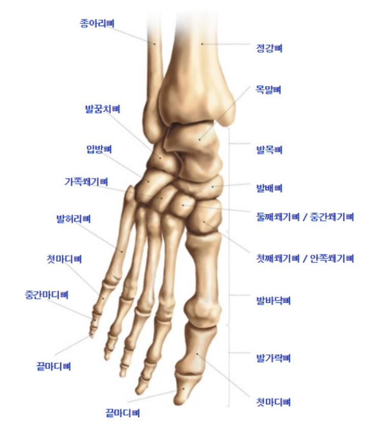 중족골 골절