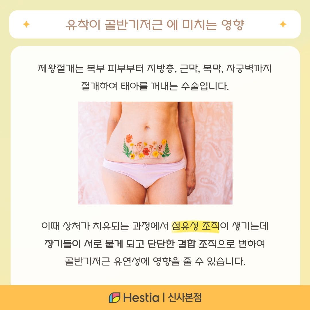 제왕절개 유착이 골반기저근 에 미치는 영향