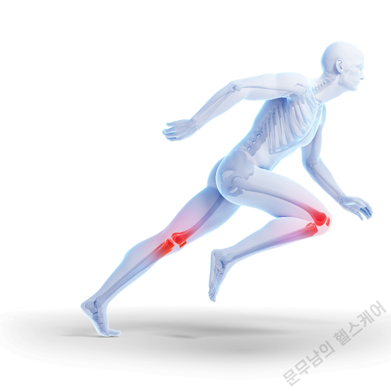 무릎에서 뚝뚝 소리나는 이유