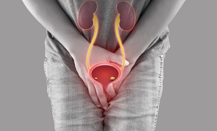 절박성 요실금 증상