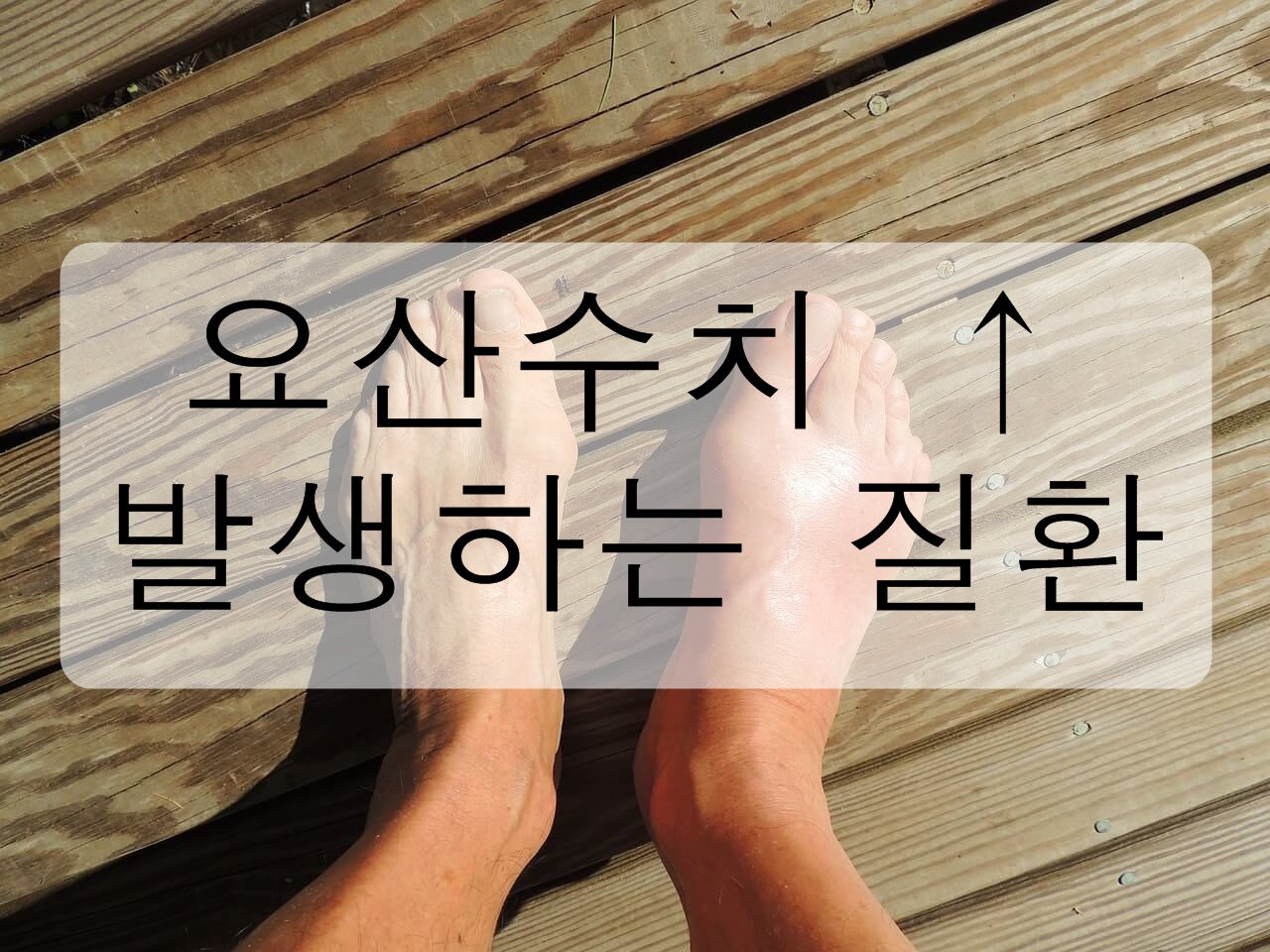 요산 수치가 높으면 발생하는 질환에 대해 알아보자! (관리방법&#44; 요산수치 줄이기)