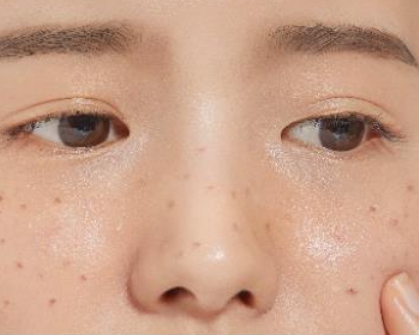 멜라토닝크림 효과