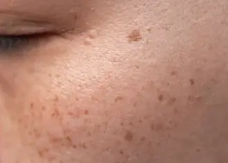 기미