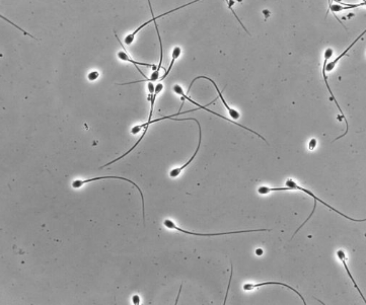 정자-생성에-좋은-음식