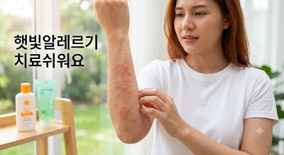 햇빛알레르기 현상