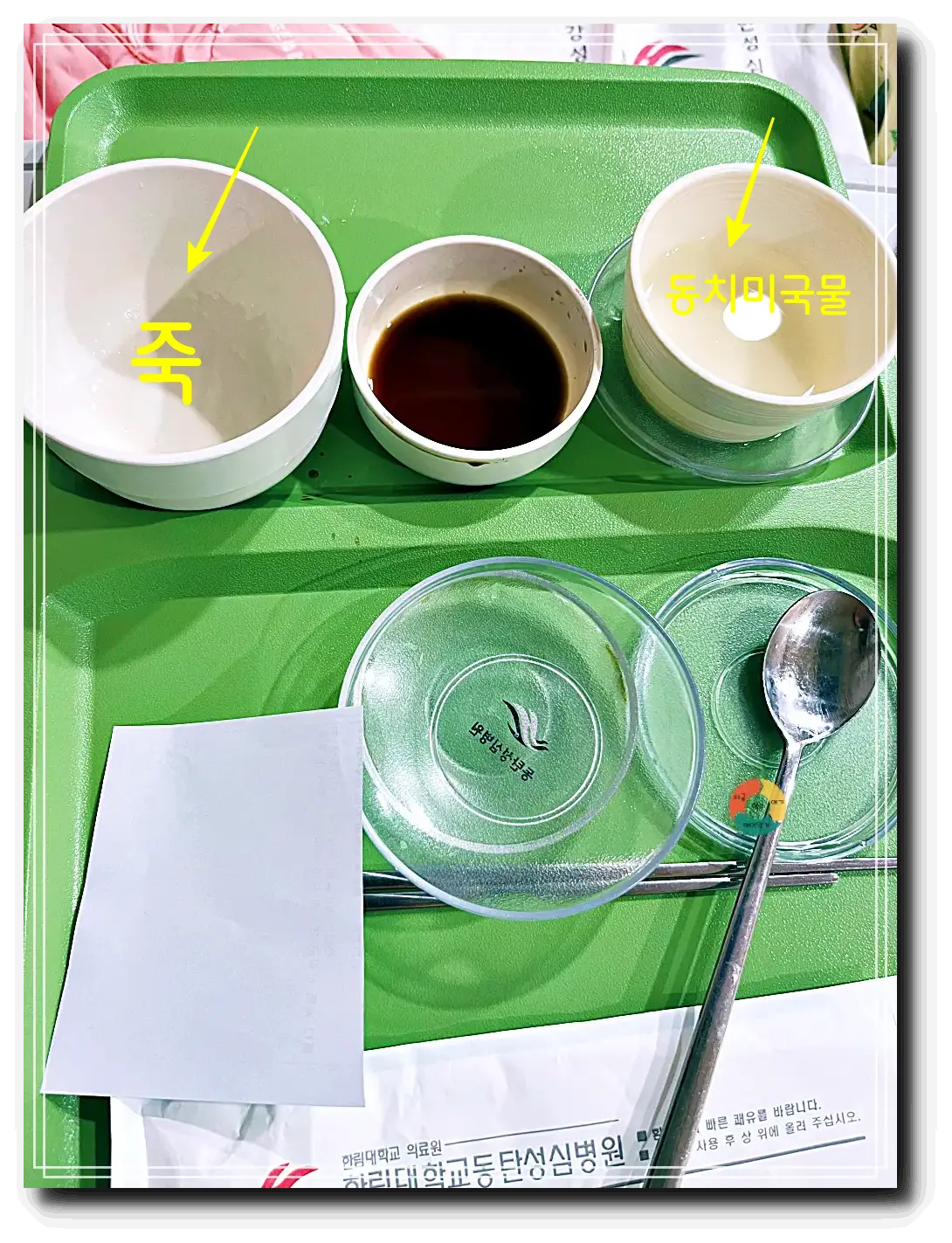 편도 아데노이드 수술_저녁식사-죽-간장-동치미국물-병원식사
