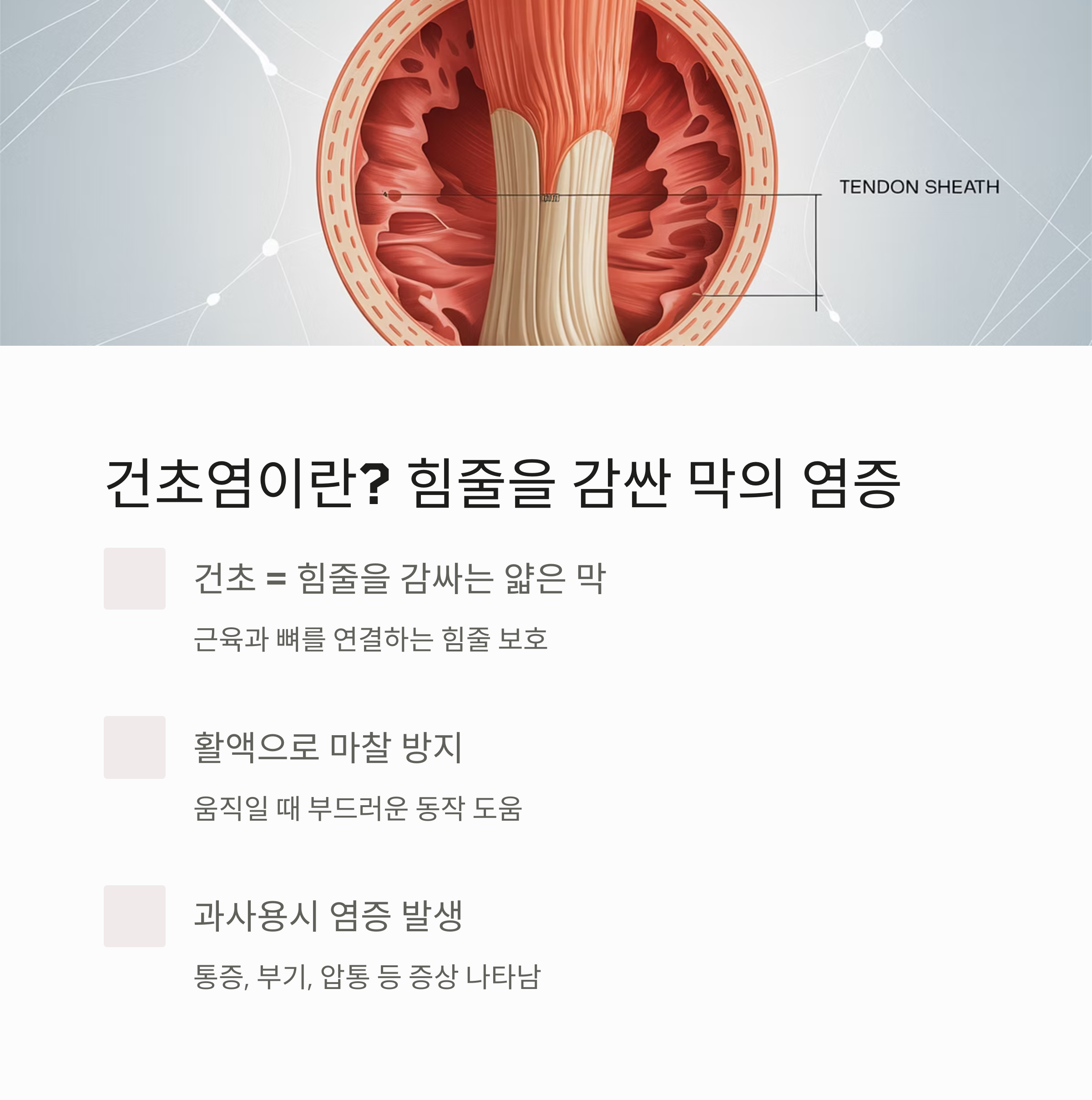 건초염의 개념을 설명하는 인포그래픽으로, 힘줄을 감싼 얇은 막의 구조와 염증 메커니즘을 표현