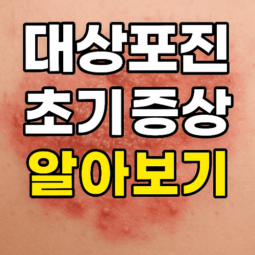대상포진 초기 증상 총정리 ❘ 놓치면 평생 후회할 수 있습니다