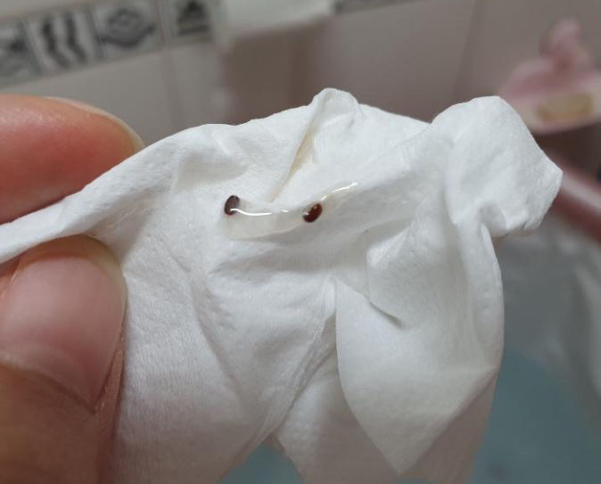 권연벌레 서식지 생기는이유 살충제 방역 퇴치법 물린자국 증상 치료방법 총정리1