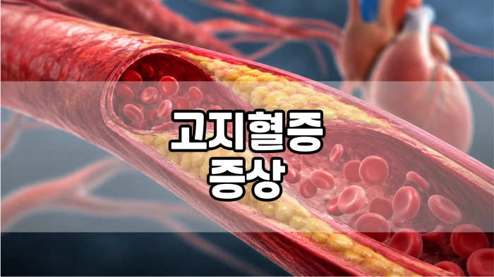 고지혈증 증상