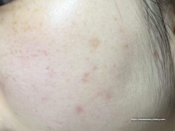 쌩얼 우측 볼사진