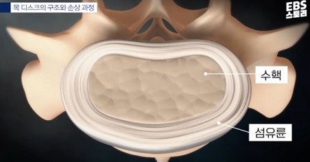 목디스크구조