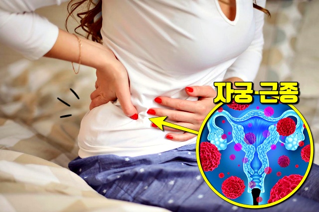 자궁 혹,자궁근종 증상 6,골반통증,팁줌