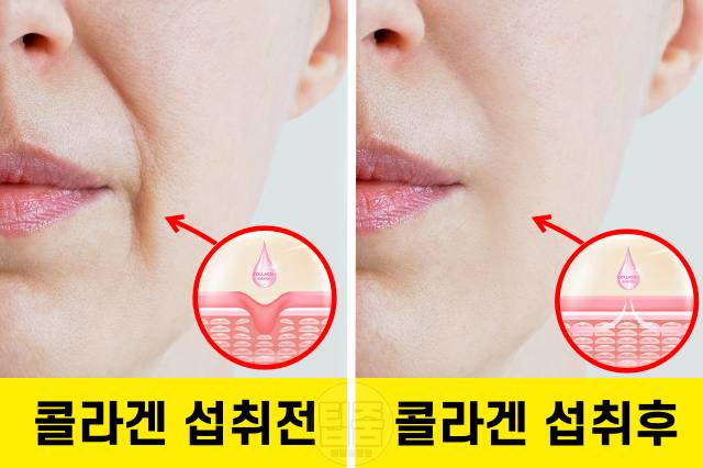 콜라겐 많은 음식 콜라겐 추천 식품 피쉬콜라겐 효능