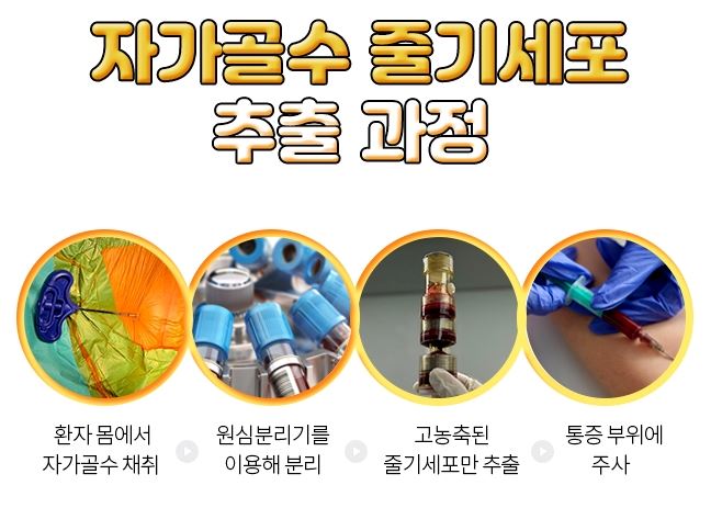 무릎줄기세포주사 가격 및 무릎줄기세포주사 실비 실손 보상 / 전국 병원추천