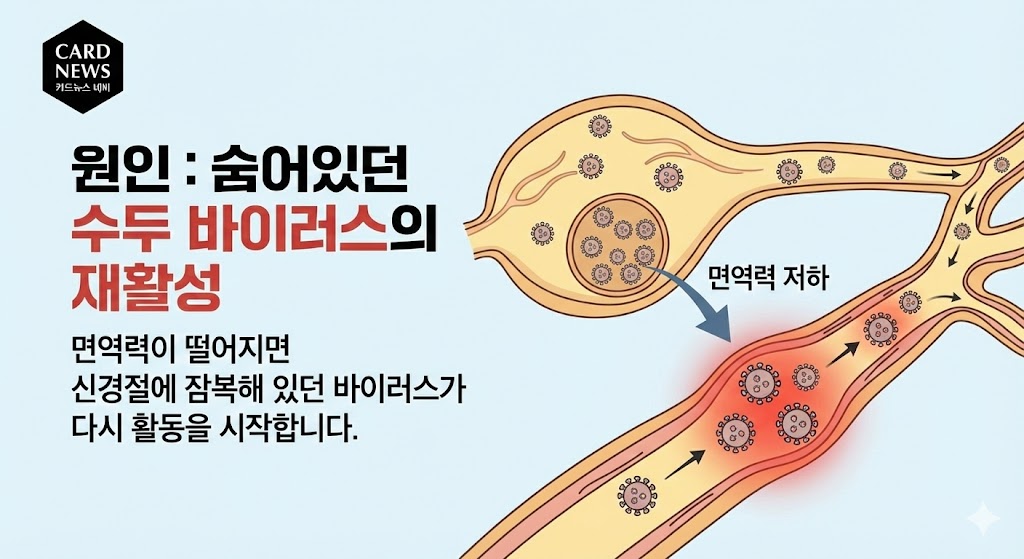 대상포진 초기증상