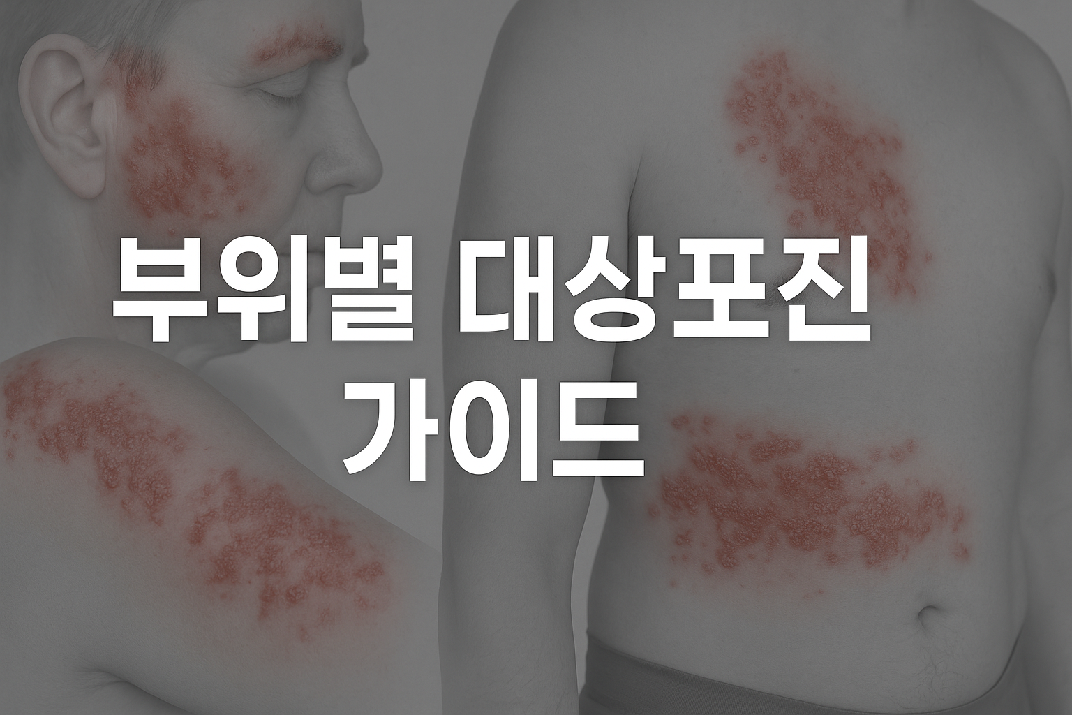 부위별 대상포진 가이드 – 얼굴, 몸통, 팔 등 부위별 증상 정리