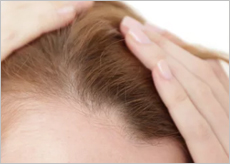 탈모로 고민하는 사람들 이미지