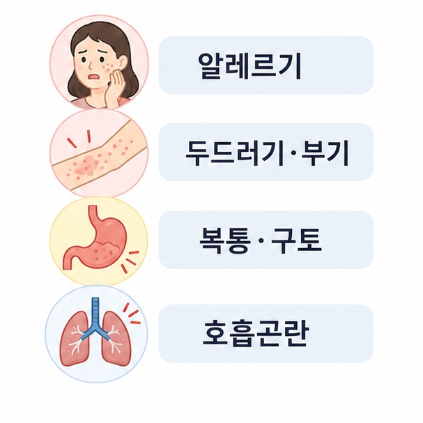 가리비 알레르기로 나타날 수 있는 두드러기, 부기, 복통, 구토, 호흡곤란을 설명한 이미지