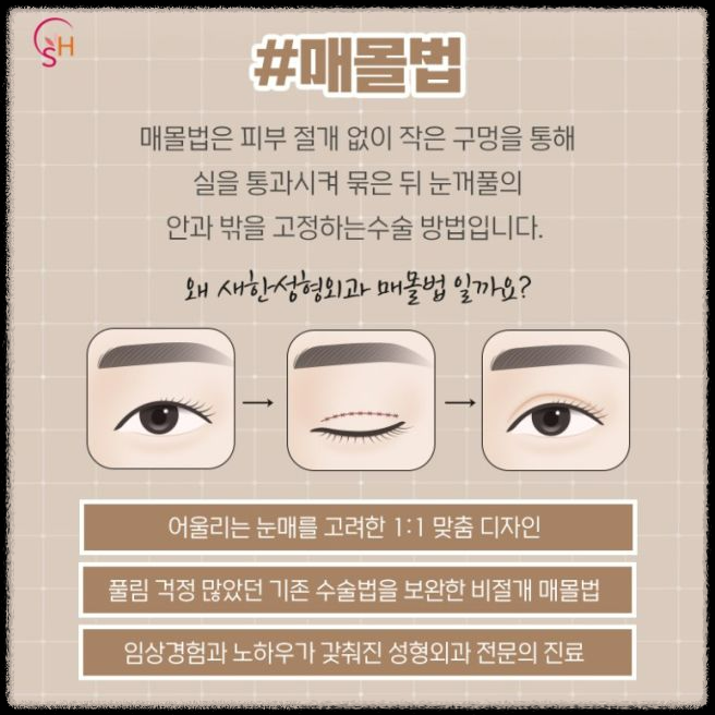 중년의 눈처짐, 쌍꺼풀 수술로 해결할 수 있을까요?