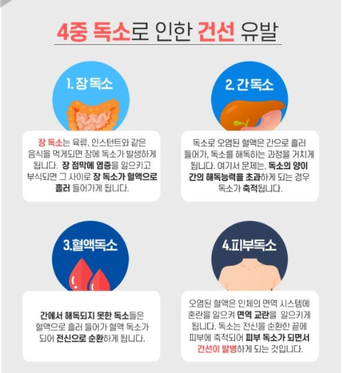 건선 원인과 증상 및 피부 변화 관련 이미지