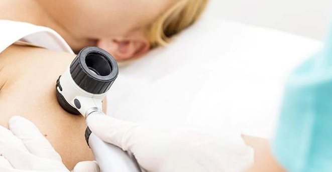 피부암 종류별 초기증상 10가지