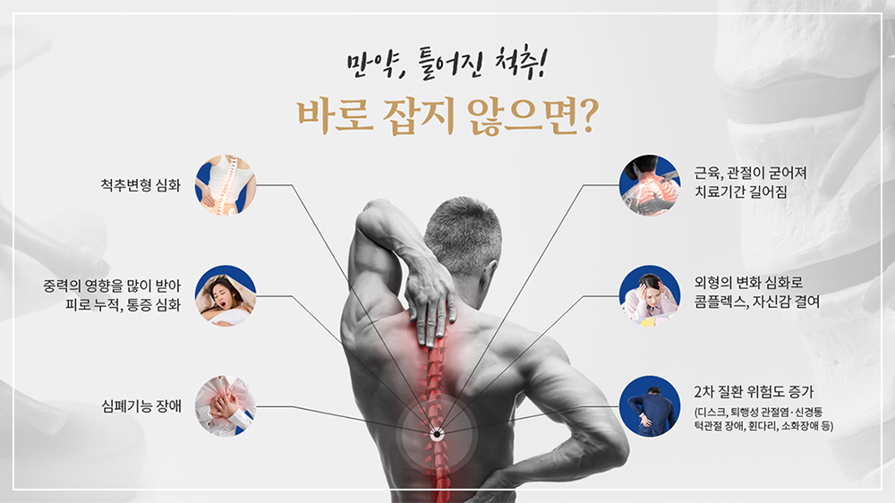 틀어진척추